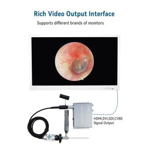 ENT endoscopy System