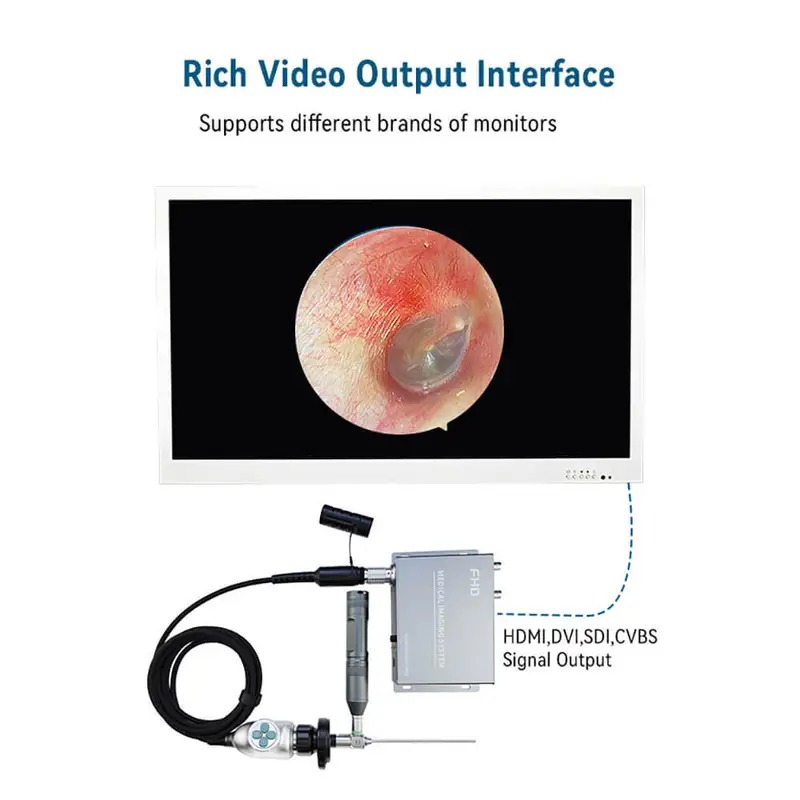 ENT endoscopy System